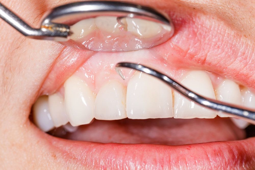 Close up of dental exam