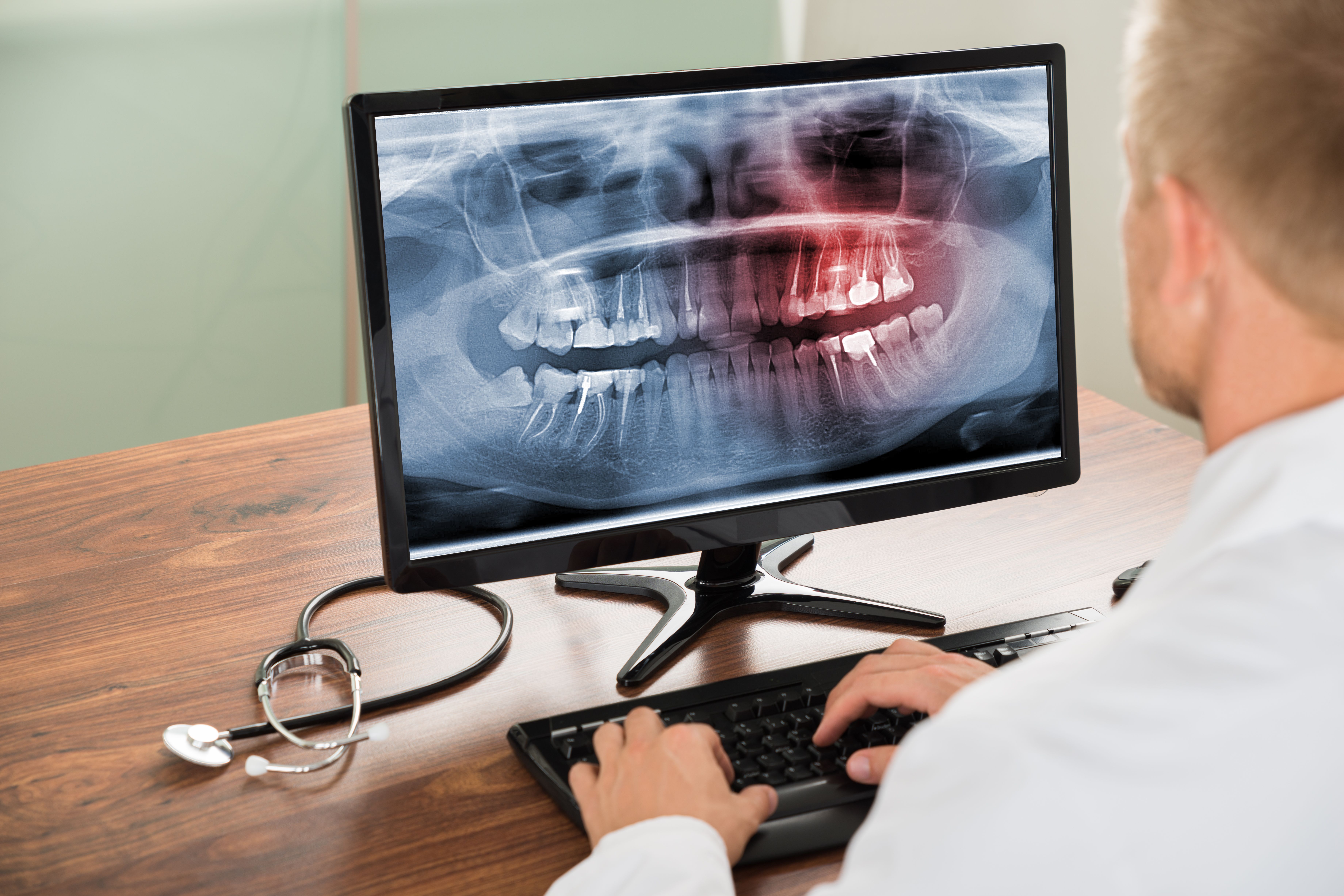 Man looking at dental x-rays on computer screen